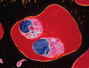 malaria parasite