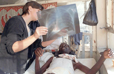 tuberculosis