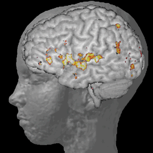 brain